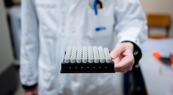 Biobanque_échantillons