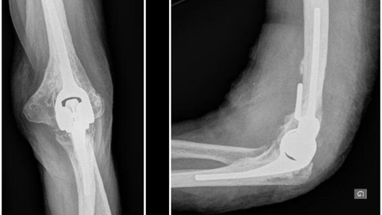 Radiographie