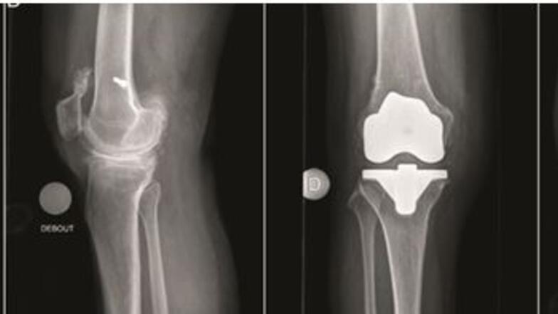Radiographie