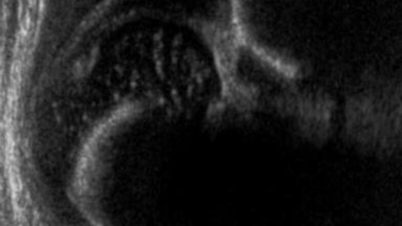 Radiographie