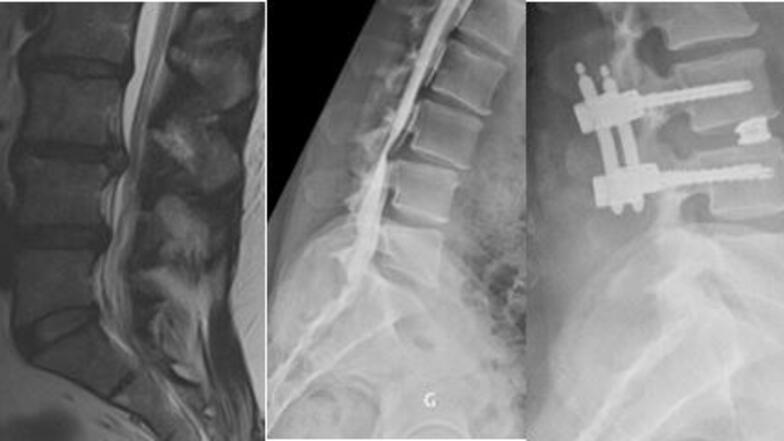Radiographie