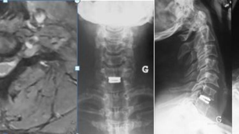 Radiographie