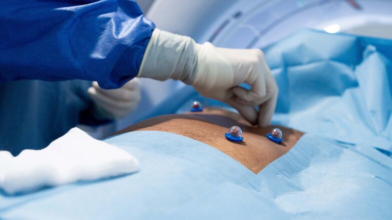 Radiologie CAScination