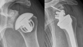 Radiographie
