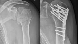 Radiographie