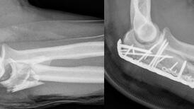 Radiographie
