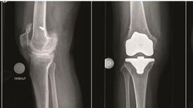 Radiographie