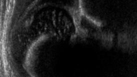 Radiographie