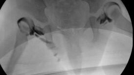 Radiographie