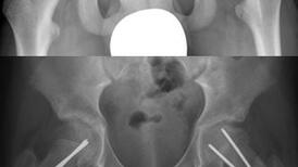 Radiographie