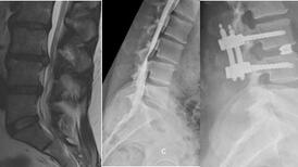 Radiographie
