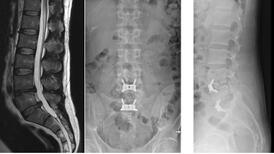 Radiographie