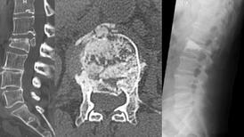 Radiographie