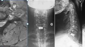 Radiographie